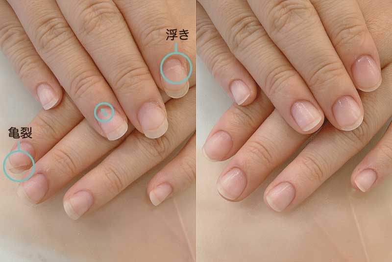 浮きと亀裂の施術例