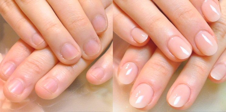 初回の仕上がりビフォーアフター実例