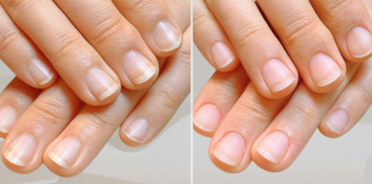 初回の仕上がり 長さ出しなしのビフォーアフター実例