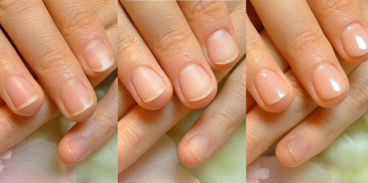 初回 長さ出しなしのビフォーアフター実例